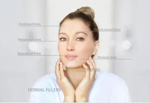 Image of a woman showing areas addressed by dermal fillers (Bellafill, Restylane): forehead lines, frown/scowl lines, periorbital lines, nasolabial folds, perioral lines, neck lines | AS3 Med Spa