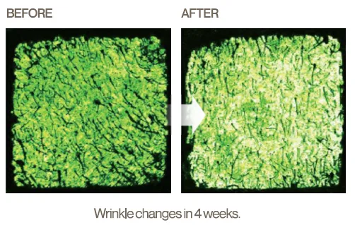 A close-up image showing before and after wrinkle changes after 4 weeks use of Flossom Serum | AS3 Med Spa