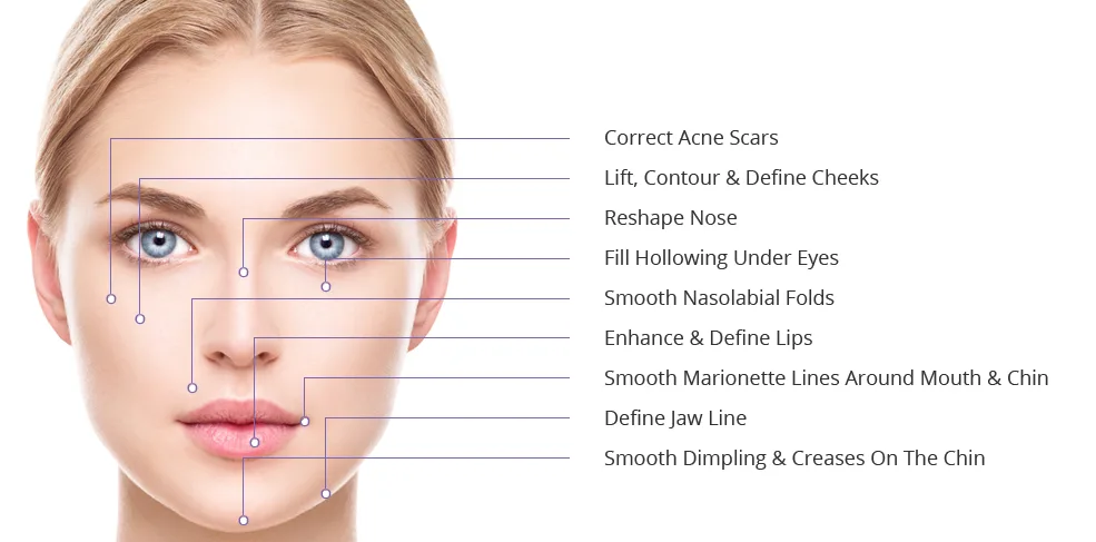 areas of treatment on face | AS3 Med Spa