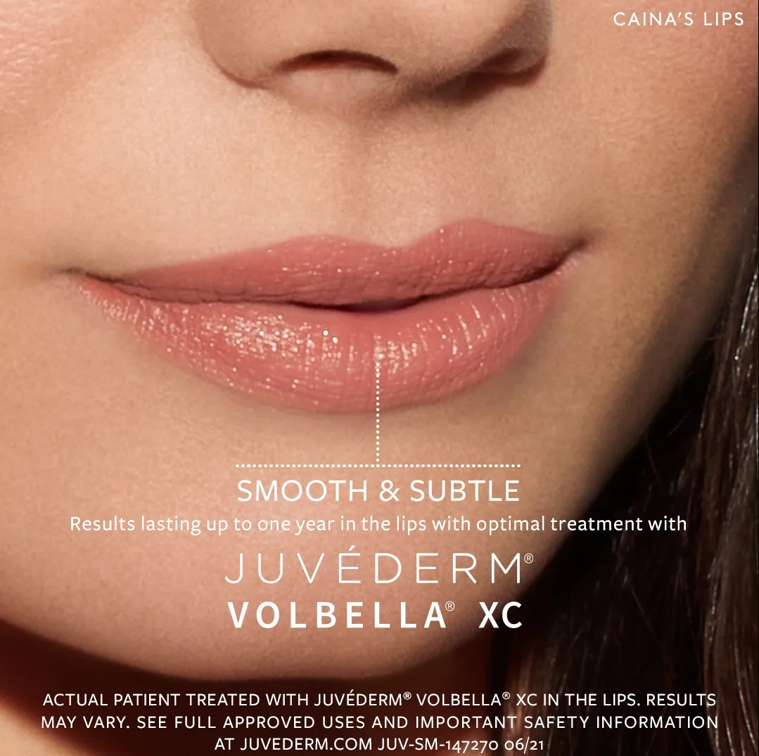 Ad of Juvederm Volbella | AS3 Med Spa